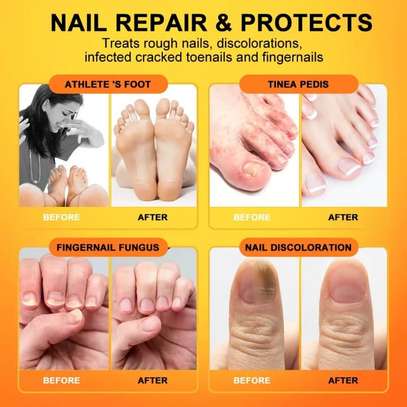 Sumifun - Bee Venom Fungal Nail Treatment Cream