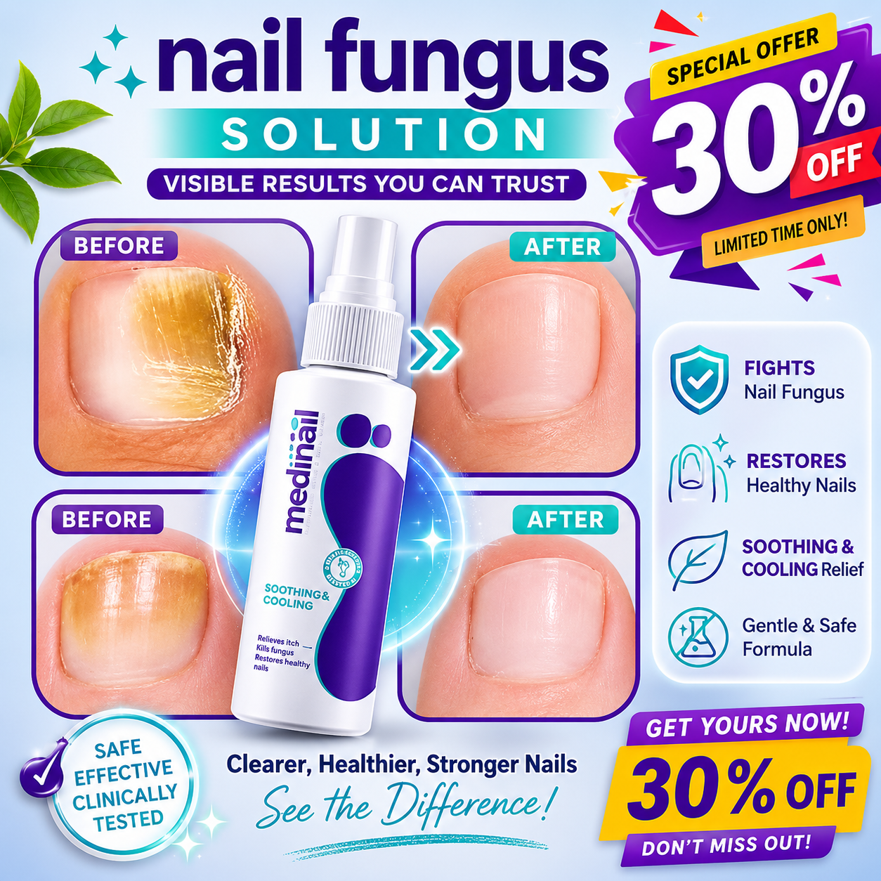 Jaysuin - Nail Fungus Spray